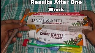Patanjali Dant Kanti Toothpaste Review After 1 Week Of Use