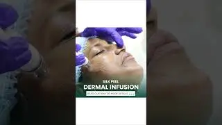 Silk Peel Dermal Infusion | Soul Skin Clinic - Anna Nagar | #shorts