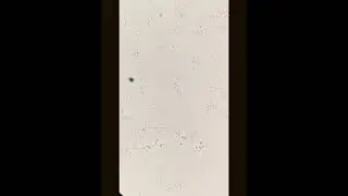 Fungal hyphae under the microscope #laboratory #microscope #mls #cls #fungi #yeastcells #spores