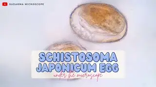 Schistosoma japonicum egg under the microscope
