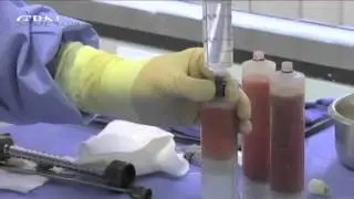 Buyer Beware: The New World of Adult Stem Cells