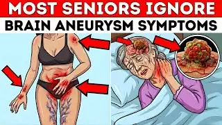 OVER 65: 8 Brain Aneurysm Early Symptoms (Most Miss #4)