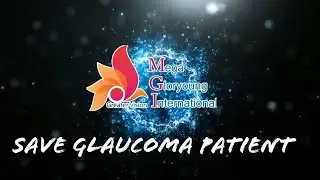 MGI CHARITY, Save Glaucoma Patient,. #MGIPHILIPPINES, #IonManSolid2020., 09488905108,09976185908