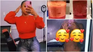 COME WITH US TO GET LIPO 360| MIA ESTHETICS