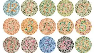 OP GAMER YT is live eye blindness test