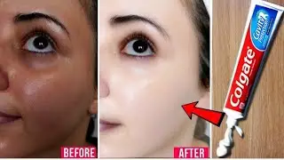 #skinwhiteningtoothpaste##howto#Skin whitening toothpaste make your face younger.