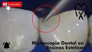 El Papel Crucial del Microscopio Dental en las Resinas Estéticas