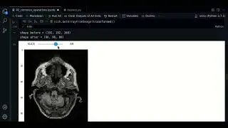 2.1 - Shrink | SimpleITK - Course MRI preprocessing with Python