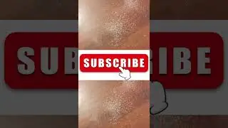 Colossal Foot rasp Foot File and Callus Remover