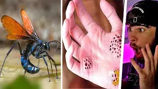 Wenn dich dieses Tier Sticht, LAUF WEG und HOL HILFE!!