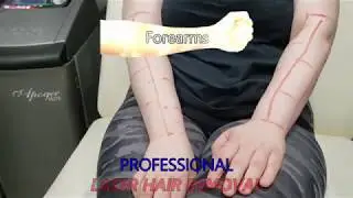 Professional Laser Hair Removal * Forearms * Video #71