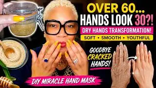Transform Dry, Cracked Hands with This Simple DIY Miracle Mask
