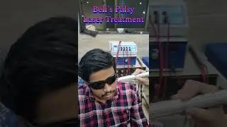 #physiotherapyclinic #physiotherapy Bell's Palsy Laser Treatment #advancedphysiotherapy