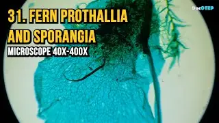 31. Fern Proth and Sporangia (Microscope 40x-400x)