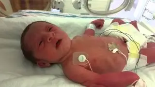 33 weeks old baby