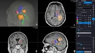 Navient Automatic Brain Segmentation