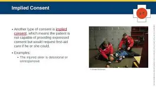 Chap 1.5 Types of Consent