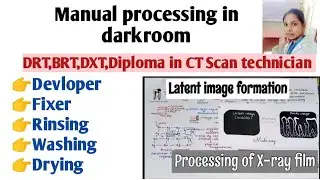 manual processing in darkroom manual processing in radiography manual processing of x ray film