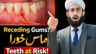 Why Are My Gums Receding?|Can gums grow back|How to STOP Gum Recession|Regrow Gums @ateeqdentalcare 