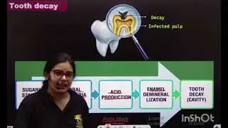Why our tooth hurts 🦷🦷#trending #biology #neetaspirents #ytshorts #education #anatomy