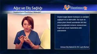 İmplantların &Ouml;zellikleri Nelerdir?