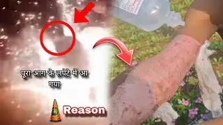 देखों क्या हुआ जब अचानक अनार फट गया - Titanium Rahul 
