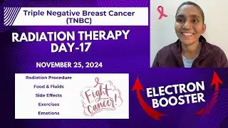 Radiation Therapy Day 17 | Electron Booster | Triple Negative Breast Cancer | TNBC | Cancer Journey