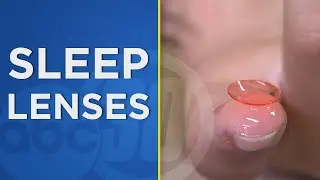 ABC30 ORIGINAL: These new contact lenses can be worn by kids while they sleep