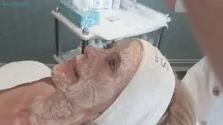 Oh! Corine krijgt de QMS Neo Tissuedermie facial!
