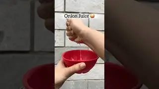 From Balding to Baby Hairs &ndash; My Onion Juice Hair Growth Story! #honestreview does onion juice work?