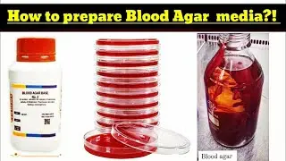 Blood Agar Preparation | Blood agar Media Preparation procedure #bacteria #microbiology #microlab