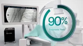 The New Standard in Lung Cancer Diagnostics