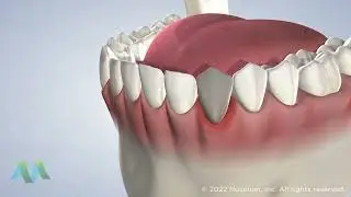 Orthognathic Surgery at Greater Michigan Oral Surgeons & Dental Implant Center