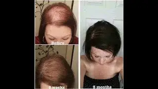 MONAT Vegan Hair Care - Before & After Results