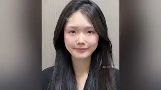 Botulax botulinum toxin type A