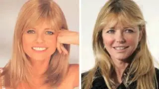 Cheryl Tiegs Before and After Plastic Surgery Photos