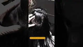 DHI Sa&ccedil; Ekimi 📣 / DHI Hair Transplantation 📣 / DHI Haartransplantation 📣/ Transplante de cabello DHI
