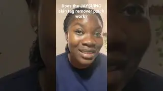 JAYSUING SKIN TAG REMOVER PATCH REVIEW (PART 2)