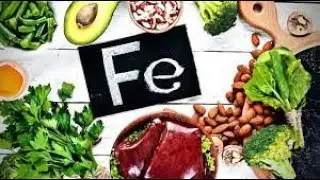 IRON DEFICIENCY DISEASE #anemia #hairloss #health