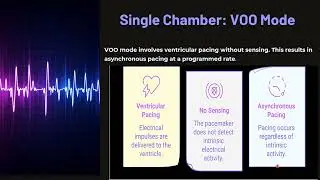 Temporary Pacemaker part 2
