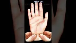 Allen's Test #shorts