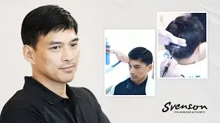 Svenson | Hair Restoration System