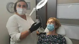 Abflachung der Tr&auml;nens&auml;cke mit PlasmaPen by Sofija Andric | Studio Fitz