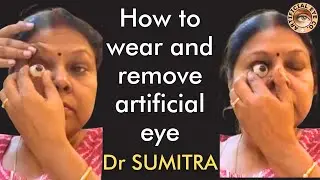 How to wear and remove artificial eye