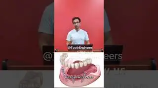 #toothless #toothimplant #toothloss #teethhealth