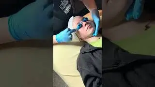 Chemical Peel Certification #3. Epionce lite refresh peel