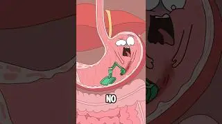Why does Helicobacter pylori cause stomach pain?#animation #funny #shorts