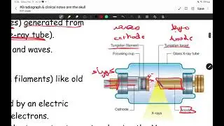 head & neck anatomy II lecture 8 radiography and clinical notes on skull II majed rumman
