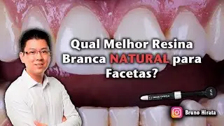 Quais melhores resinas para facetas de dentes BRANCOS NATURAIS?