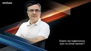 Stomatoloq məsləhəti  (1) - dişlərin daş bağlamaması üçün nə etmək lazımdır?